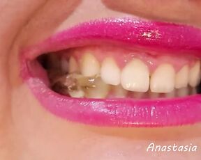 teeth   (preview) Model Anastasia Gree